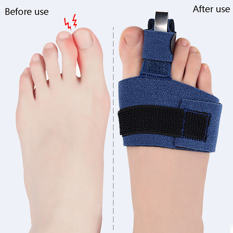 1 Stück Zehenkorrektor, Zehenb – Ankle Brace Sock Bewertung und Preis